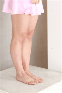 Thumnail / 0 / 11 / 32