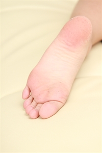 Thumnail / 0 / 12 / 56