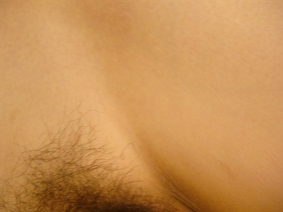 Thumnail / 0 / 19 / 51