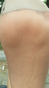 Thumnail / 0 / 20 / 26