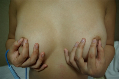Thumnail / 0 / 31 / 50
