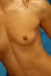 Thumnail / 1 / 10 / 12