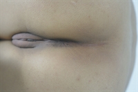 Thumnail / 1 / 10 / 48