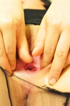 Thumnail / 1 / 15 / 26