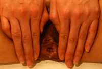 Thumnail / 1 / 19 / 60