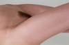 Thumnail / 2 / 10 / 42