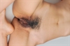 Thumnail / 2 / 10 / 47