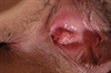 Thumnail / 2 / 10 / 76