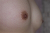 Thumnail / 2 / 18 / 23