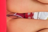 Thumnail / 2 / 20 / 27