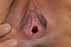 Thumnail / 2 / 21 / 23