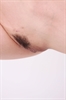 Thumnail / 2 / 22 / 03