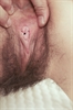 Thumnail / 2 / 30 / 06