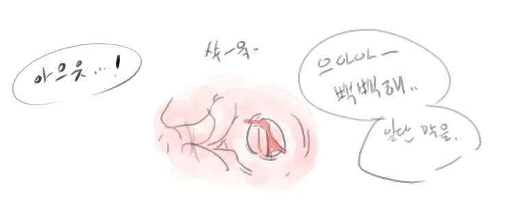 넷캔